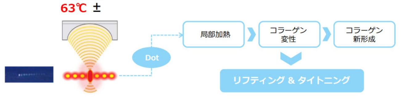 ウルトラセルQ＋のメカニズム①