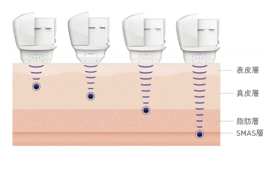 ウルトラセルQ＋のメカニズム②