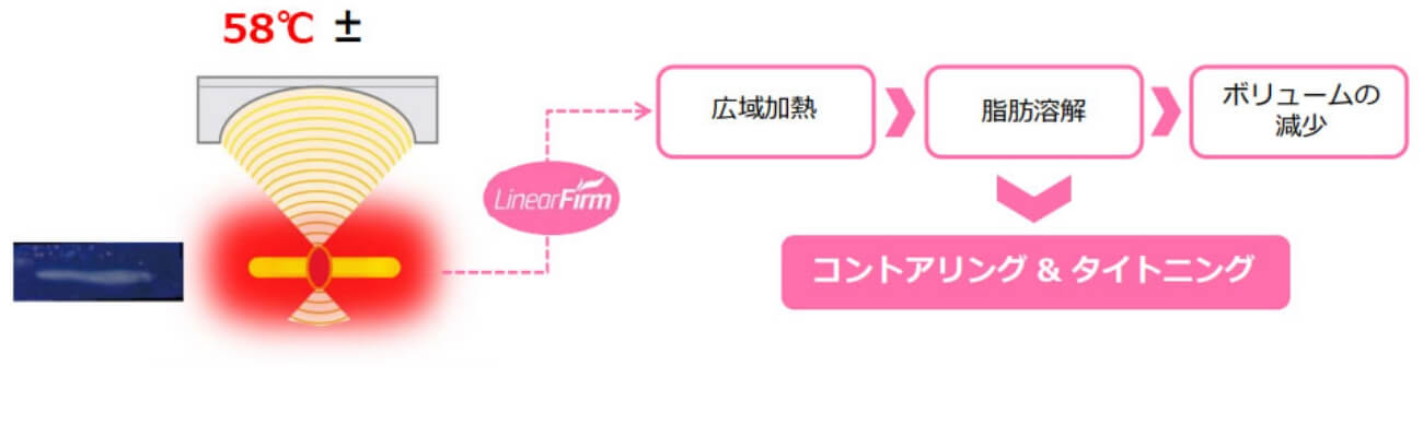 ウルトラセルQ＋(リニアファーム)のメカニズム①