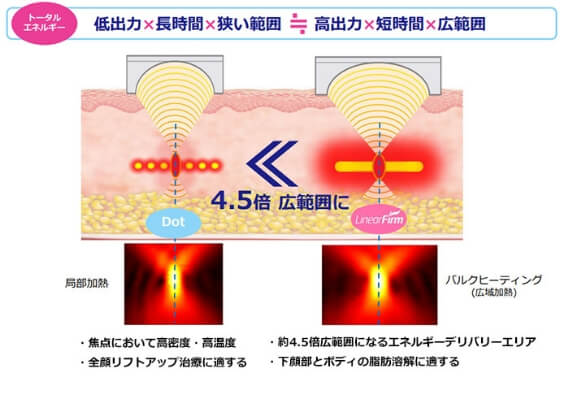 ウルトラセルQ＋(リニアファーム)のメカニズム②