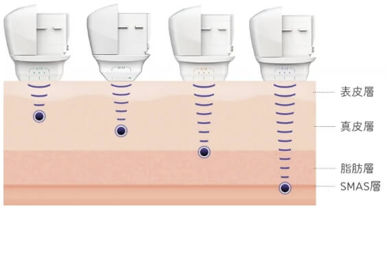 カートリッジによる深さの違い