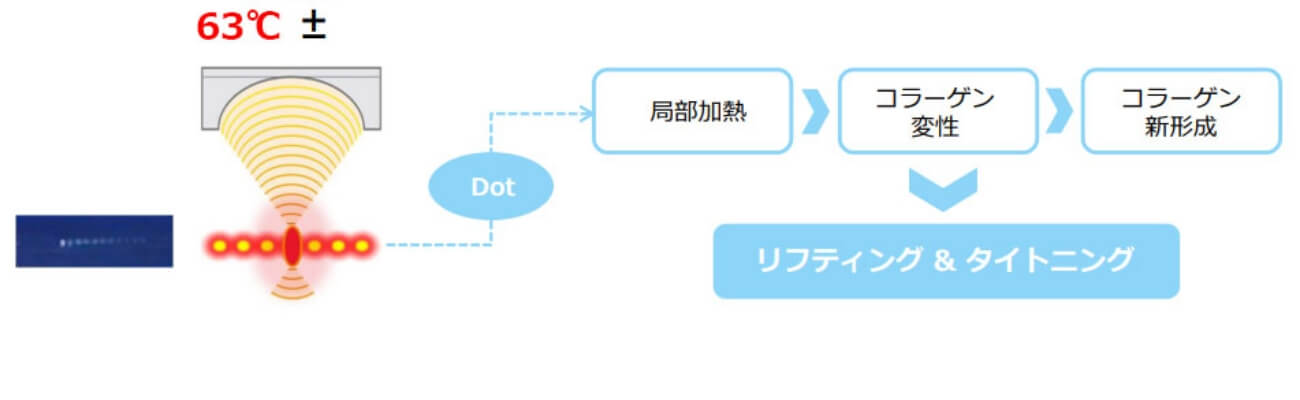 ウルトラセルQ＋のメカニズム